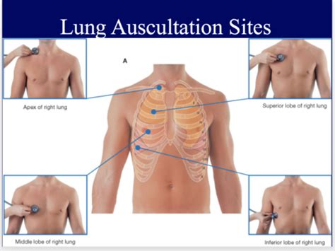 Lung Auscultation Review Flashcards Quizlet