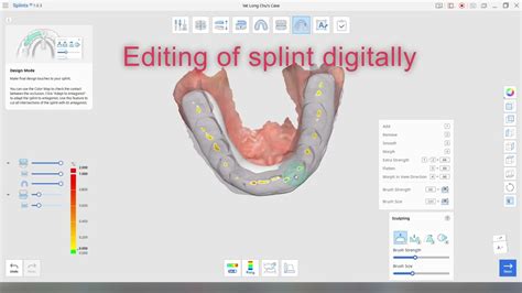 My Socials Ai D Printing Orthodontic Implant Services