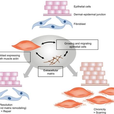 Schematic Illustration Showing The Evolution Of The Myofibroblast