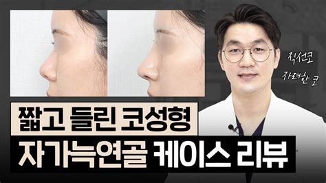 유튜브 1 페이지 나를 위해 선택한 차민성형외과