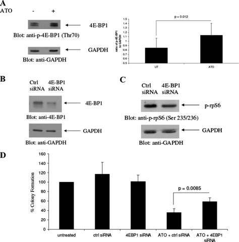 As 2 O 3 Dependent Phosphorylation Of 4e Bp1 In Primary Leukemic Download Scientific Diagram