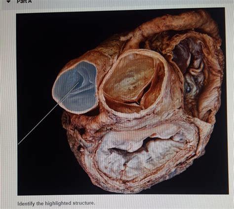 Solved Identify The Highlighted Structure Part A Identify Chegg
