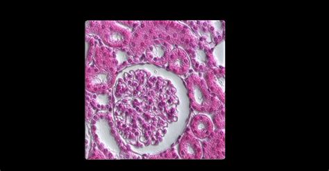 3D model Histology Glomerulus VR / AR / low-poly | CGTrader