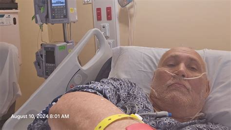 fundraiser  bill bates assist bill bates  recovery period