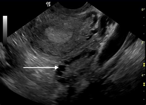 Ultrasound Sonography Concise Medical Knowledge