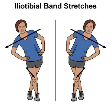 Chondromalacia Patella Exercises | Patient Handouts | 5MinuteConsult