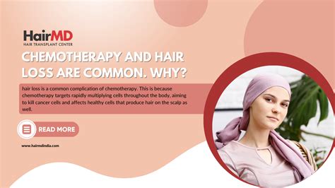 Chemotherapy And Hair Loss Are Common Why