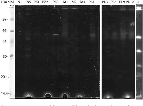 Figure 1 From Digestive Lipase Activity Through Development And After