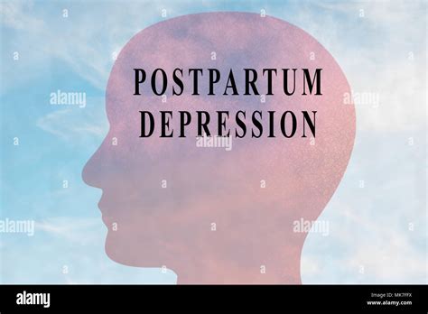 Render Illustration Of Postpartum Depression Title On Head Silhouette