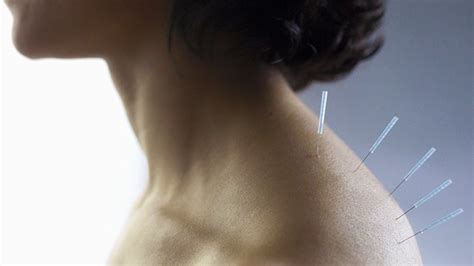 Acupuncture Best For Hot Flashes In Breast Cancer Survivors Everyday Health