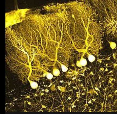 Purkinje Cell MEDizzy