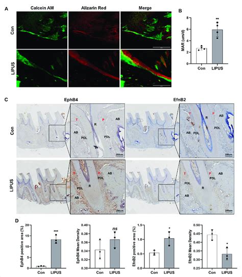 Lipus Improves Compensatory Bone Formation In Otm Via Ephrinb2 Ephb4 Download Scientific