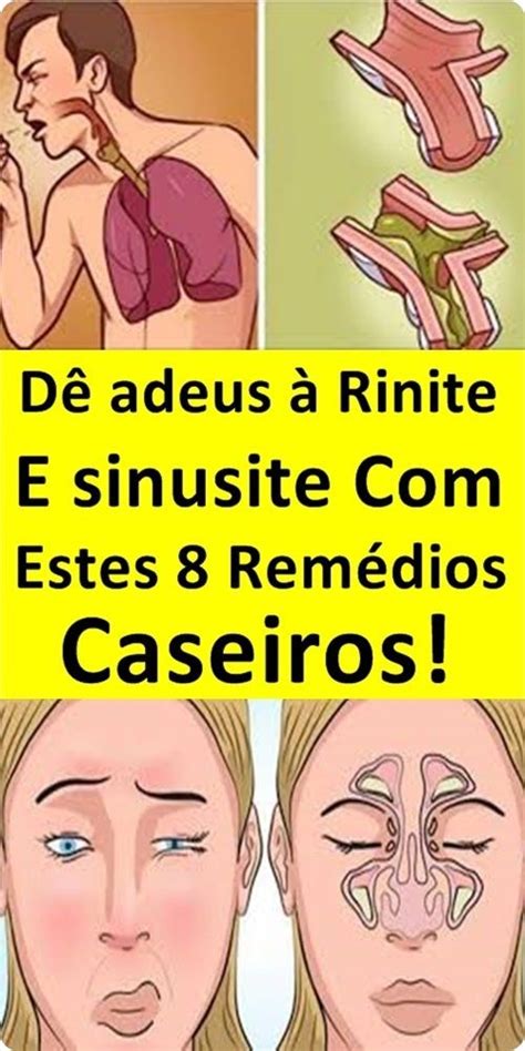 Dê adeus à rinite e sinusite estes 8 remédios caseiros Memes Ecards