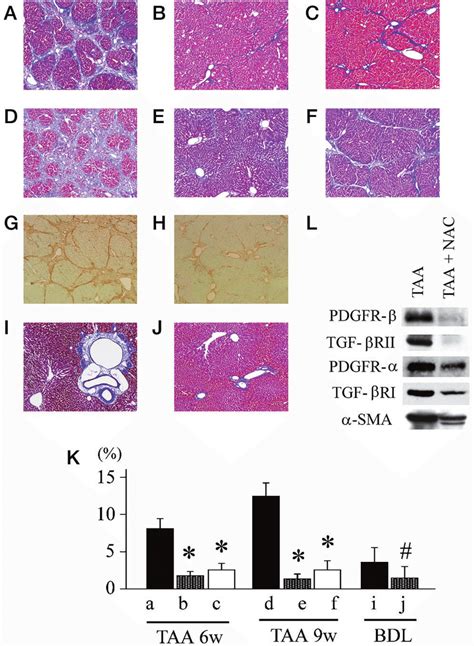 Effect Of Nac On Rat Liver Fibrosis Models Ah Taa Was Administered