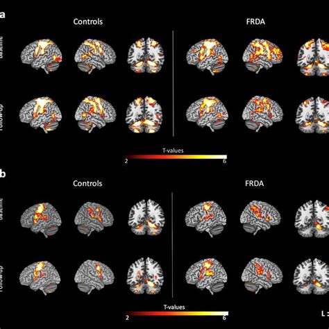 Brain Regions Showing Significant Within Group Functional Activation