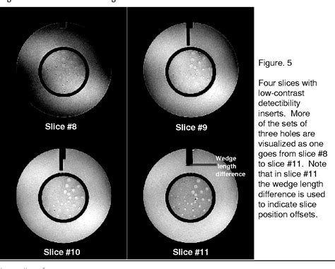 Figure 5 From Overview Of The Acr Mri Accreditation Phantom Semantic Scholar