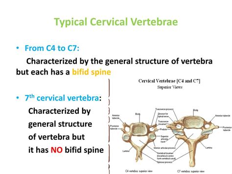 Atypical Cervical Vertebrae