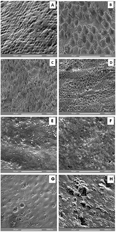 Sem Images Of Un Bracketed Premolar Buccal Enamel Surfaces A An