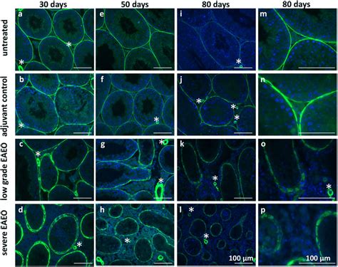 Distribution Of Smooth Muscle Actin Sma In Paraffin Sections From