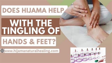 How Hijama Cupping Helps With Tingling Of Hands And Feet Helps Hijama