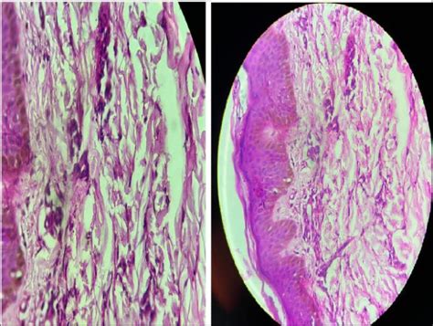 Histopathological Features Download Scientific Diagram