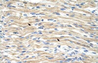 Bloch Sulzberger Syndrome: Disease Bioinformatics: Novus Biologicals