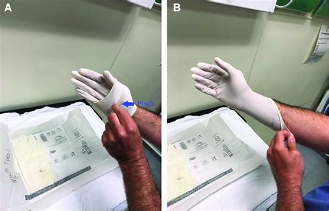 Proper Sterile Gloving Technique For Nonoperating Room Sterile