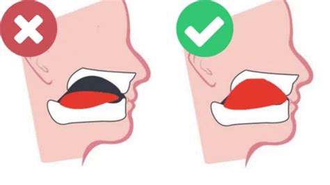 Proper Mewing Tongue Posture: Before and After Adopting Correct Resting Tongue Position