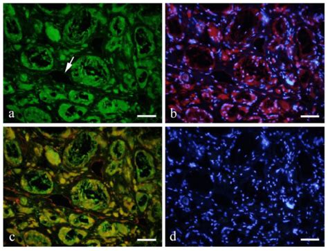 Double Staining With Gfp Green A And Cd31 Red B With Dapi Showed