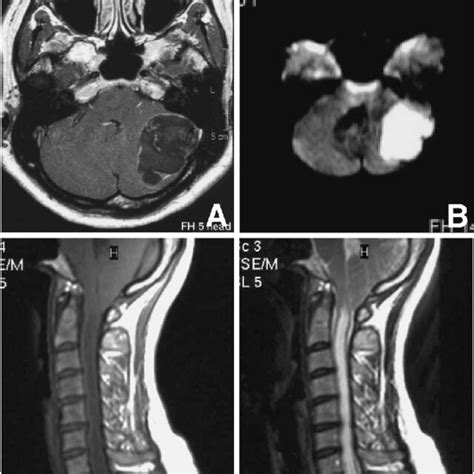 A Axial T 1 Weighted Magnetic Resonance Mr Image With Contrast Download Scientific Diagram