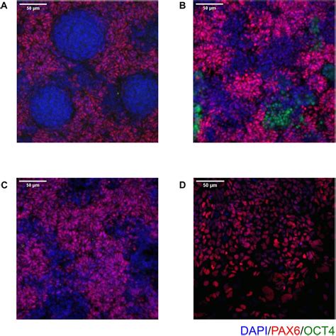 Frontiers Differentiation Of Human Induced Pluripotent Stem Cells