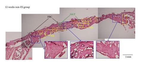 This Figure Shows Transverse Histological Sections Of Calvarial Defect Download Scientific