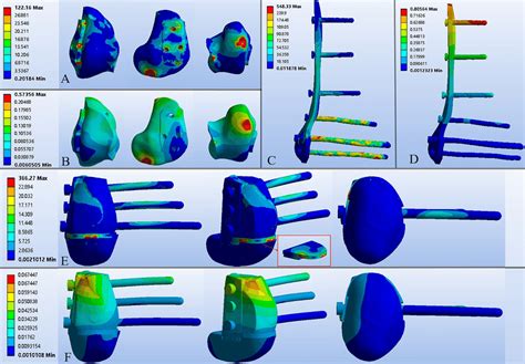 The Displacement And Stress Distribution Of Implants A B The Stress Download Scientific