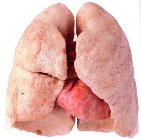 Lungs After Quitting Smoking | New Health Advisor