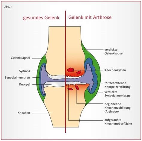 Das Gelenk