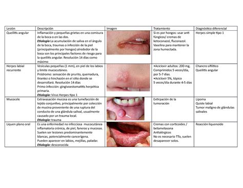 Pdf Lesiones Erosivas En Mucosal Oral Y Ocular Hot Sex Picture