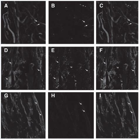 Double Immunofluorescence Staining Of Spinal Cord Dorsal Column