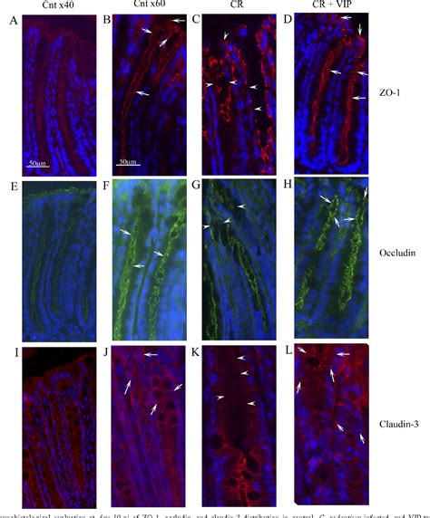 Figure 1 From Vasoactive Intestinal Peptide Ameliorates Intestinal