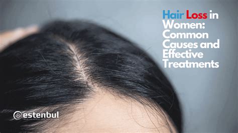 Hair Loss In Women Common Causes And Effective Treatments Estenbul