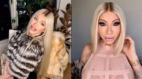 Real Life Barbie Is Embracing The Natural Look After Spending £40000 On Plastic Surgery