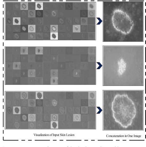 Table 1 From Skin Lesion Segmentation And Multiclass Classification