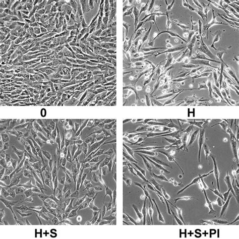 Phase Contrast Microscopy Of Cultured Human Rpe Cells Treated With Hcq