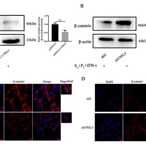 YPEL3 regulated the Wnt β catenin signaling pathway Western blot