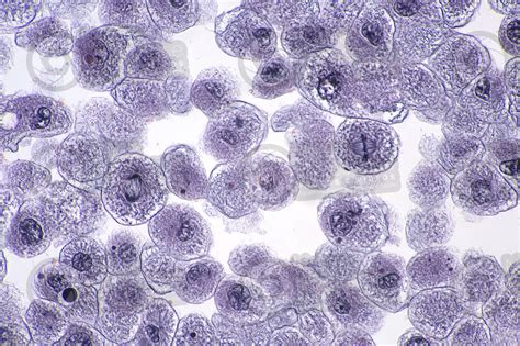 Coregonus sp. Whitefish. Blastodisc. Mitosis. Transverse section. 500X - Overview - Mitosis ...