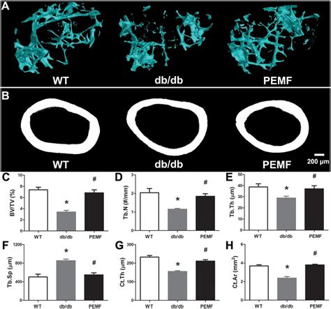 Effect Of Pemf Exposure On Trabecular Bone Microarchitecture In Distal