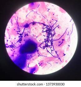 Microscopic Fungi Malassezia Furfur Showing Yeast Stock Photo