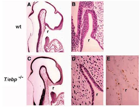 Figure 1 from Formation of Rathke's pouch requires dual induction from the diencephalon ...