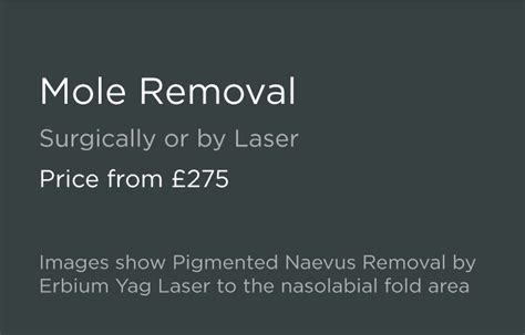 Laser Mole Removal Leeds Bradford Good Skin Days