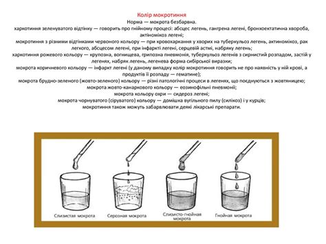 Методи дослідження мокротиння - презентация онлайн