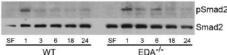 Extra Type III Domain A EDA Cellular Fibronectin CFN Is Dispensable